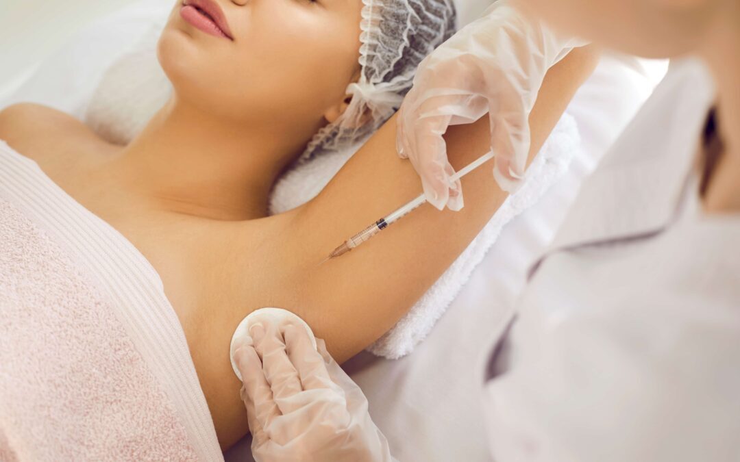 Miradry: A Revolutionary Treatment for Excessive Underarm Sweating