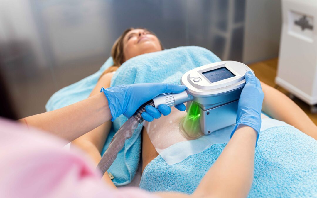 The CoolSculpting Experience: What It Feels Like to Freeze Fat Away