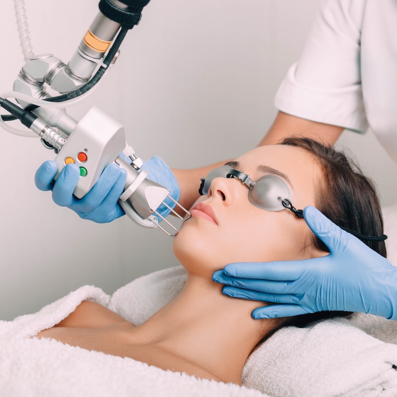 woman receiving laser facial treatment