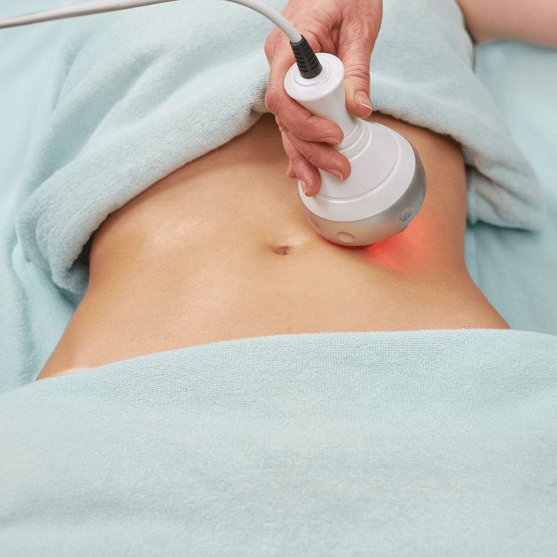 woman receiving body contouring treatment