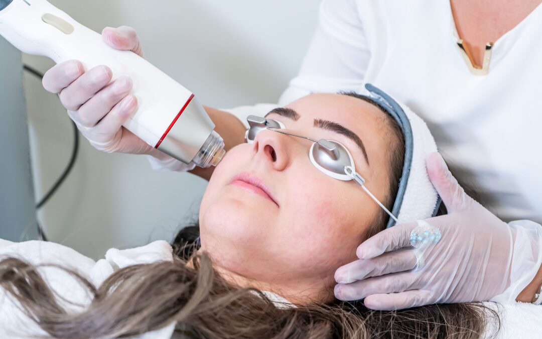 Beautician applying radio frequency microneedling handpiece to a woman's face for skin tightening treatments at a beauty clinic