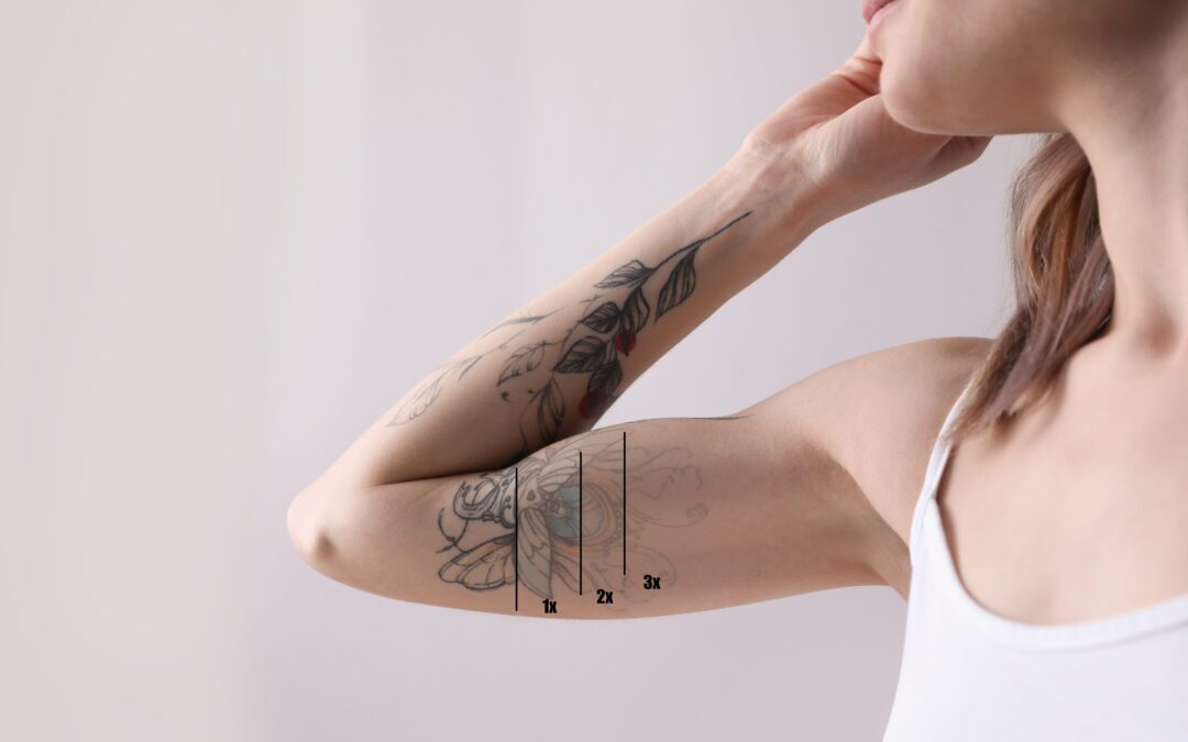 Woman before and after laser tattoo removal procedures on light background, closeup